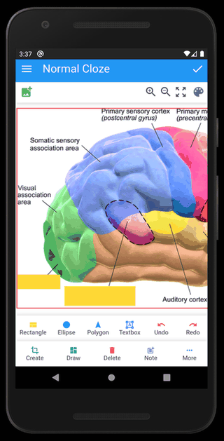 Anki Image Occlusion screenshot