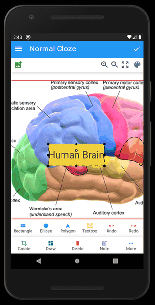 Anki Image Occlusion screenshot