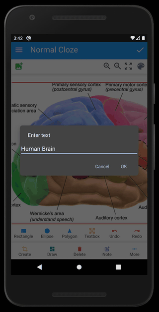 Anki Image Occlusion screenshot
